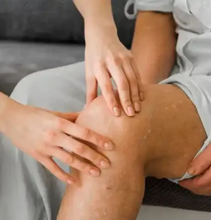 Varicose Veins